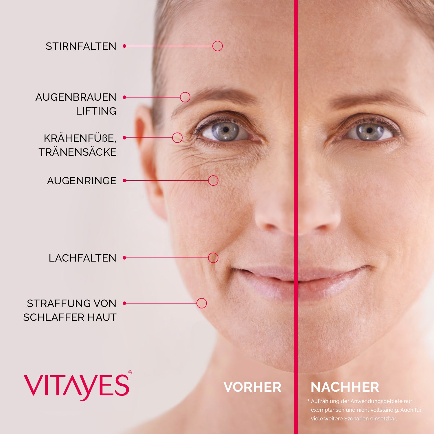 Instant Ageback Lifting-Creme gegen Tränensäcke und Falten, klinisch bestätigt, in einer weißen Dose mit blauen Akzenten
