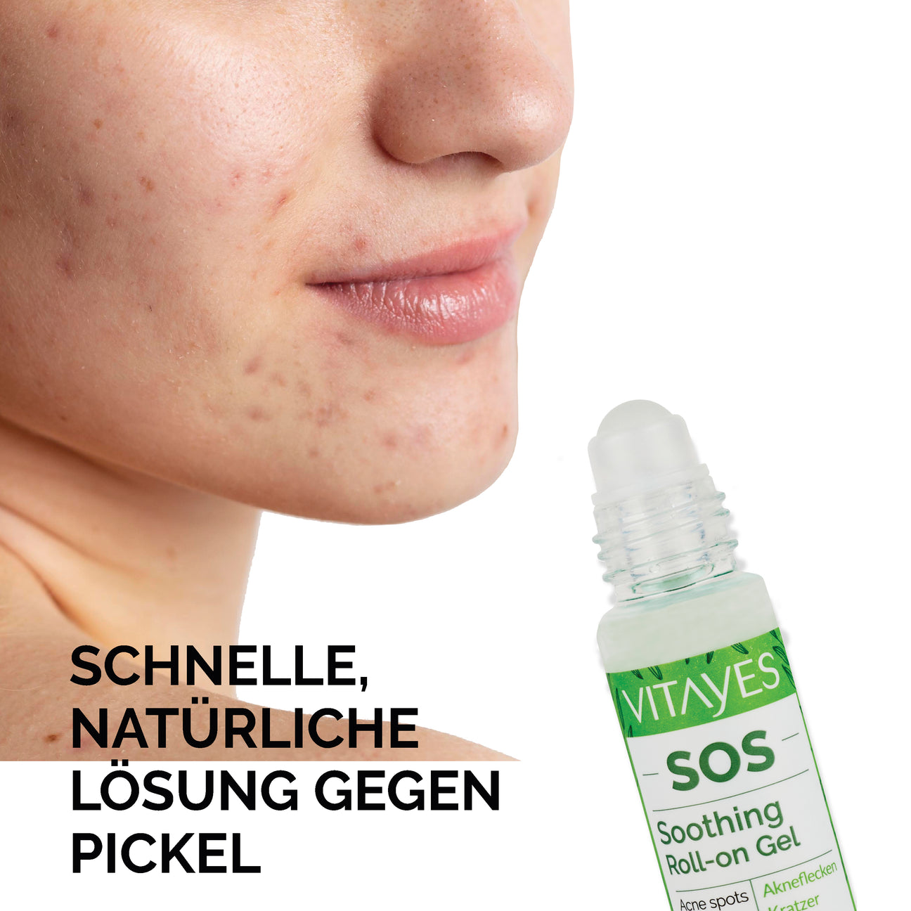 Vitayes Sos Sooting Gel