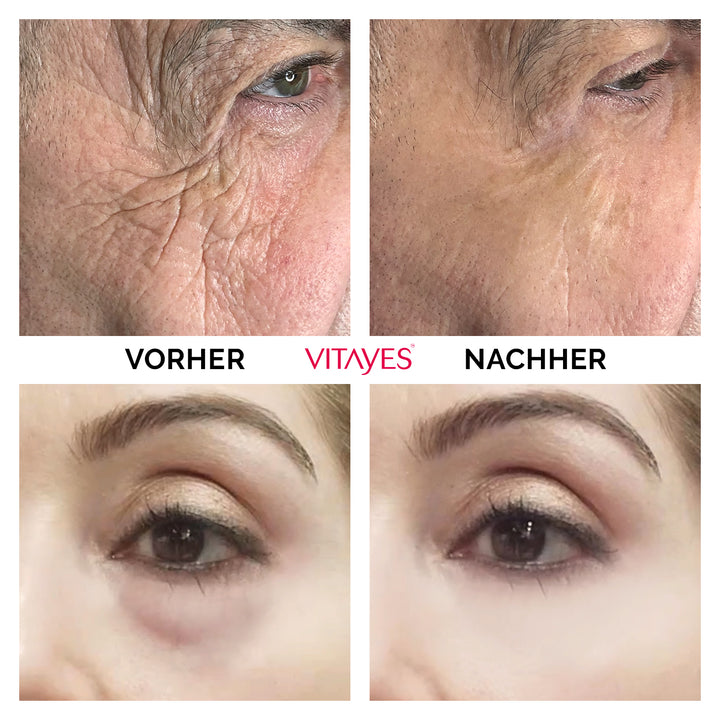 Instant Ageback Anti Aging Creme gegen Augenringe Tränensäcke Soforteffekt Faltencreme