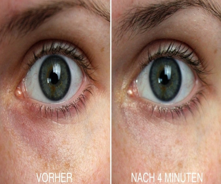 Vitayes Perfector illuminating Augenserum